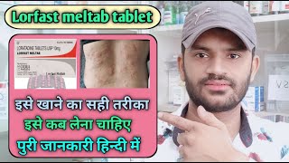 Lorfast meltab tablet use dose benefits and side effects full review in hindi loratadine [upl. by Otreblide]