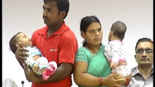 AIIMS doctors separate conjoined twins successfully [upl. by Yatnuahc]