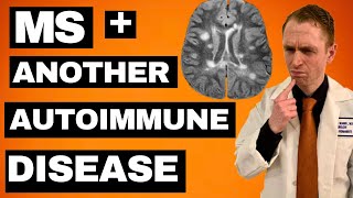 MS  Another Autoimmune Disease Treatment Options [upl. by Tayyebeb153]