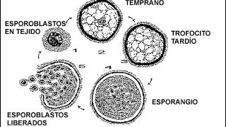 RHINOSPORIDIOSIS [upl. by Rozanne]