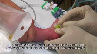 Paediatric Anaesthetics Chapter 7  Long saphenous IV neonate 1 [upl. by Ikcin]