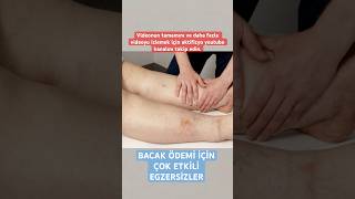 Bacak ödemi için çok etkili egzersizler aktifizyo fiziktedavi ödem [upl. by Eire]