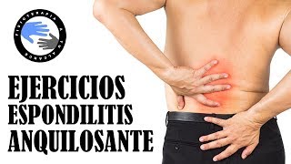 Ejercicios para espondilitis anquilosante tratamiento para aliviar los sintomas y el dolor [upl. by Tomasz]