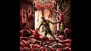 Traumatomy  Transformation Into A Putrid Mass 2013 FullEP [upl. by Oneladgam]