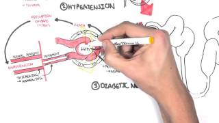 Chronic Kidney Disease CKD Pathophysiology [upl. by Ianaj]