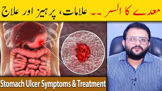 Stomach Ulcer Symptoms amp Treatment  Stomach Ulcer Ka Ilaj  Maidey Ka Ulcer  Dr Raja Omer Fiaz [upl. by Conchita]