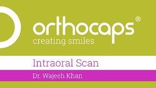 Intraoral Scan [upl. by Ariat]