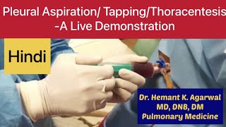 Pleural Aspiration Pleural Tapping Thoracentesis Needle Pleurocentesiss HINDI [upl. by Atiugal]