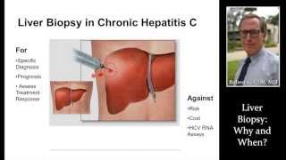 What is Liver Biopsy Test Use amp How to Perform  Indications  Complication  Cost [upl. by Lyrak]