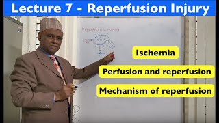 General Pathology  Lecture 7  Reperfusion Injury [upl. by Jade]