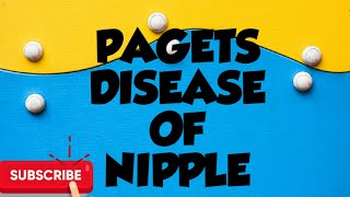 PAGETS DISEASE OF NIPPLE [upl. by Corabella]