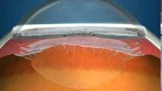 How Fluid Circulates in the Eye [upl. by Lillie]