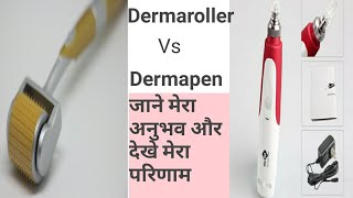 Dermaroller Vs Dermapen [upl. by Gnus402]