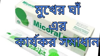 Micoral Oral gel এর কাজ কি  মাইকোরাল ওরাল জেল ব্যবহারের নিয়ম  Micoral Oral gel [upl. by Jecho424]