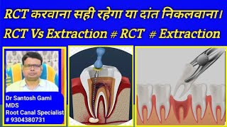 RCT करवाना सही रहेगा या दांत निकलवाना। RCT Vs Extraction  RCT  Extraction  Root Canal Treatment [upl. by Akceber277]