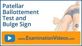 Patellar Ballottement Test and Bulge Sign [upl. by Berga255]