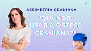 Dra Clarice  Responde quotQuando é indicada a órtese cranianaquot  O famoso quotcapacetinhoquot [upl. by Nyladnarb207]