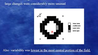 Field progression  which method to use part 1 [upl. by Aciria686]