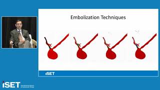 Pulmonary Arteriovenous Malformations Disease Economic Burden and Treatment Options [upl. by Atterg73]