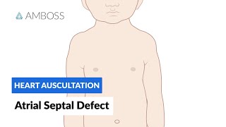 Atrial Septal Defect  Heart Auscultation  Episode 7 [upl. by Collen]