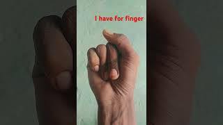 I have for fingers shorts 🤪🤪👌👍 funny comedy [upl. by Lud]