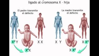 Distrofia muscular de Duchenne [upl. by Harden]