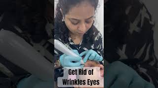 Get rid of wrinkles Eyes Dr Mona Swamy [upl. by Anauqes]