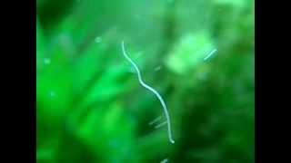 Nematoda in aquarium [upl. by Emerick]