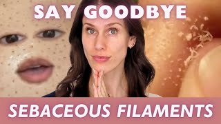 How To Get Rid Of Sebaceous Filaments [upl. by Ahsinehs]