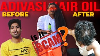 ADIVASI HAIR OIL SCAM  MY PERSONAL EXPERIENCE [upl. by Muhan]