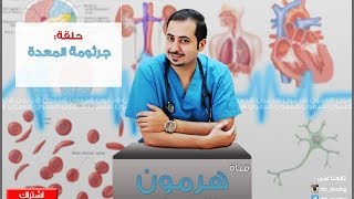 قناة المجد اسباب تكرار حدوث جرثومة المعدة وطريقة فحص الجرثومة امام المشاهدين ج 3 د محمد الغندور [upl. by Nile428]