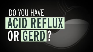 Do You Have Acid Reflux or GERD [upl. by Julide]