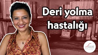 Deri yolma hastalığı [upl. by Woodrow]