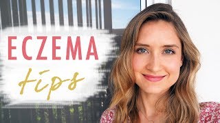 HOW TO HEAL ECZEMA  Top 5 Natural Tips [upl. by Oiramal485]