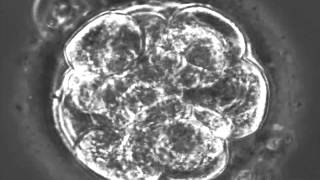 Timelapse observation of fertilized mouse embryo up to the blastocyst stage [upl. by Etteluap]