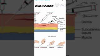 Different route of injection administration of drugs route injection shorts 3danimation viral [upl. by Nosmirc]