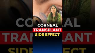 Corneal Transplant Side Effects [upl. by Myrtice]