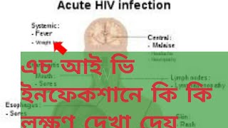 wat r the early symptoms of HIV infectionacute hiv syndromebengali [upl. by Enieledam]