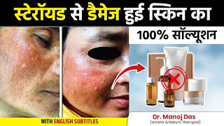 Skin Sensitivity Allergy Redness Treatment at Home  Steroid Skin Problems  Dr Manoj Das [upl. by Duwalt]