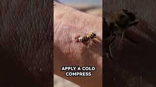 Bee sting treatment bee bees beesting [upl. by Kristel]