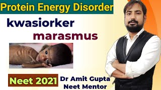 kwashiorkor and marasmus disease in hindi  protein energy malnutrition disorder  neet 2025 biology [upl. by Cutler]