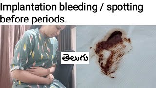 Telugu Implantation bleeding  Is it Pregnancy symptom [upl. by Card]