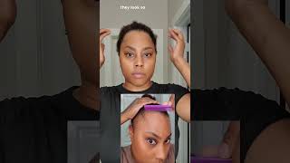 This Product Helped Restore My Hairline alopeciahairloss hairlosstreatment htx naturalhair [upl. by Acirej]