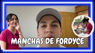 QUEMADURAS CONTROLADAS para eliminar las MANCHAS DE FORDYCE I JAVIER DERMA [upl. by Nosinned]