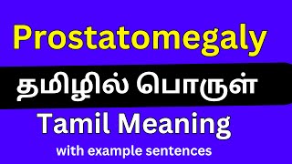 Prostatomegaly meaning in TamilProstatomegaly தமிழில் பொருள் [upl. by Africa]