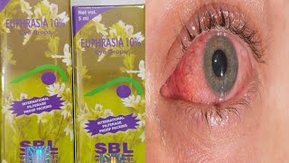 EUPHRASIA EYE DROPS  यूफ्रेसिया आंख का ड्रॉप हिंदी में  EUPHRASIA EYE DROPS IN HINDI [upl. by Pellegrini]