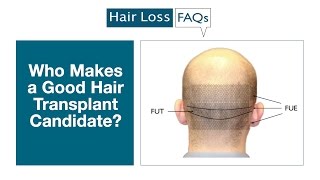 Who Makes a Good Hair Transplant Candidate [upl. by Biddie]