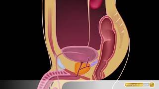 Urogenitalsystem Niere und Harnblase [upl. by Nitsraek]