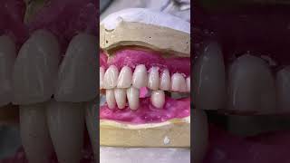 Teeth arrangementdentalworld trendingshorts related to dentistry bestdentalhospital kirtikvlogs [upl. by Mita]