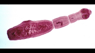 Echinococcus Multilocularis  The Small Fox Tapworm [upl. by Hogarth]